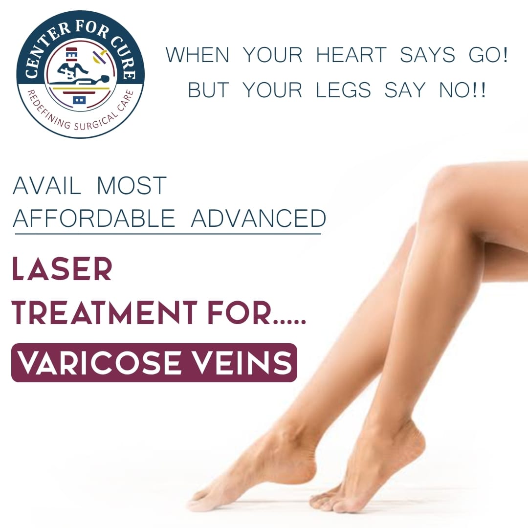 Varicose Veins Laser Treatment in Delhi NCR