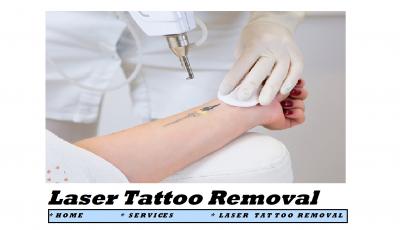 Top-Notch Laser Tattoo Removal Services in Dubai | drypSKin Dubai - Dubai Health, Personal Trainer