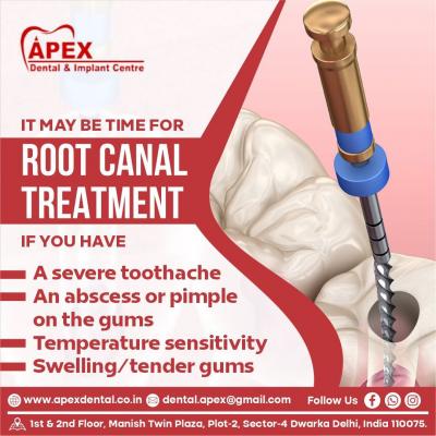 Root Canal Centre in Dwarka | Best Root Canal Treatment in Dwarka | Apex Dental - Delhi Health, Personal Trainer