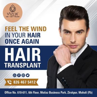 Affordable Hair Transplant Services in Chandigarh - Chandigarh Health, Personal Trainer