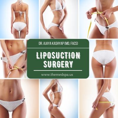 Body Jet Liposuction Surgery India