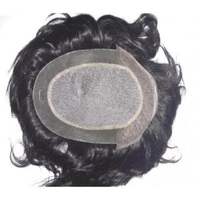 frontlace hair patch