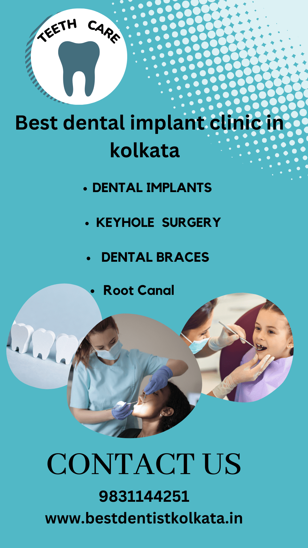 Teeth Care : Get Best Root Canal Treatment in Kolkata - Kolkata Health, Personal Trainer