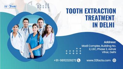 Tooth extraction treatment in Delhi | 32facts