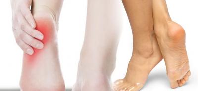 Calcaneal Heel Spur Treatment | Boynerclinic.com - Delhi Health, Personal Trainer