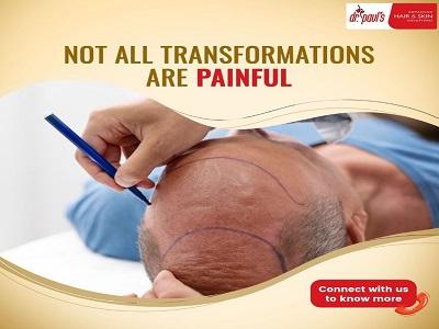 Affordable hair transplant cost in Kolkata at Dr. Paul's Hair Transplant Clinic - Kolkata Health, Personal Trainer