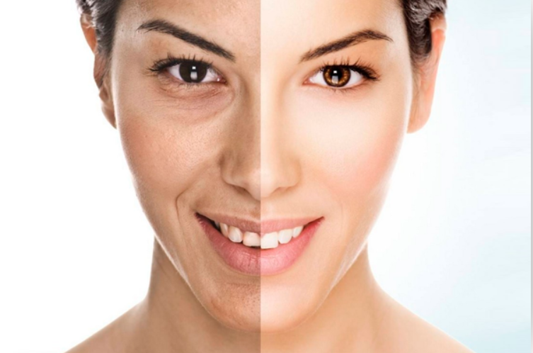 Skin Whitening Treatment in Ahmedabad Can Transform Your Skin