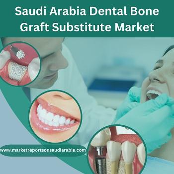 Saudi Arabia Dental Bone Graft Substitute : Market Trends, Size, Growth, Opportunity and Forecast ti - Dubai Other