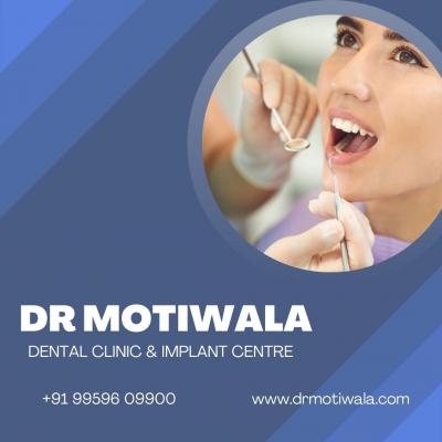 Full Mouth Dental Implants Before and After - Hyderabad Health, Personal Trainer