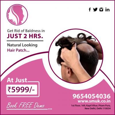 Best Hair Patch in Pitampura and Rohini