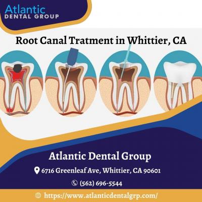Root Canal Treatment in Whittier, CA - Other Other