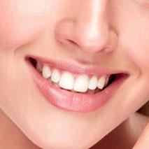 Teeth Polishing and Teeth Cleaning in Delhi at affordable cost