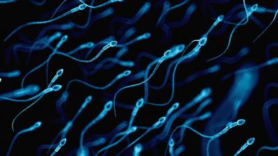 Semen Fructose Test - Assessing Male Fertility Potential by Agilus Diagnostics - Kolkata Other