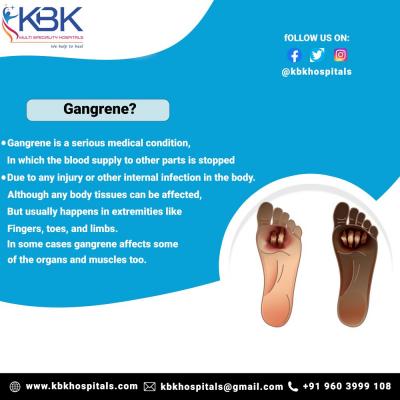 Gangrene Treatment in Hyderabad - Hyderabad Health, Personal Trainer