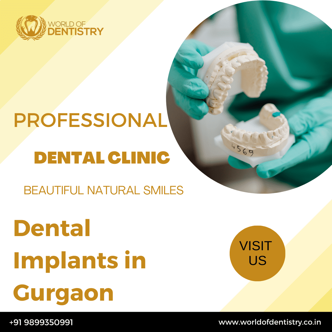 Dental Implants In Gurgaon - Gurgaon Health, Personal Trainer