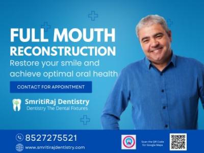 Best Dental Clinic in Delhi - Delhi Health, Personal Trainer