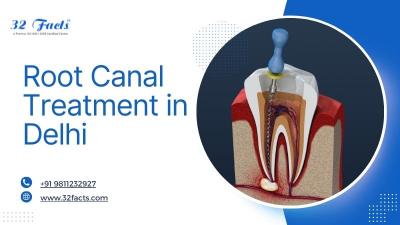Root canal treatment in Delhi | 32facts
