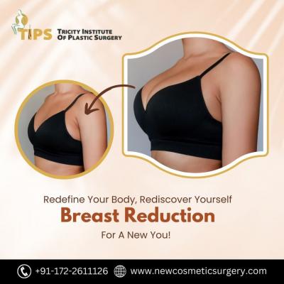 Enhance Comfort & Confidence with Breast Reduction in Chandigarh  - Chandigarh Health, Personal Trainer