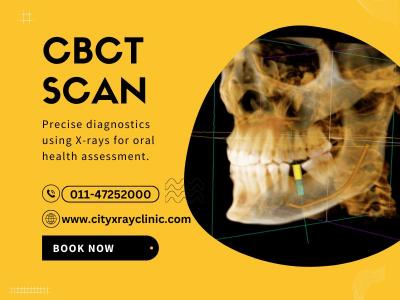 CBCT Scan Near Me in Delhi At Affordable Price 