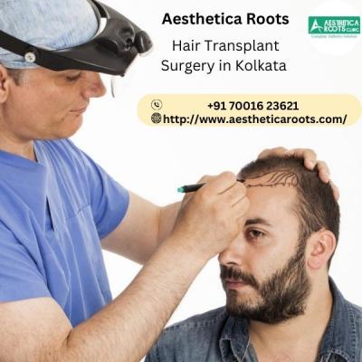 Hair Transplant Surgery in Kolkata | Aesthetica Roots