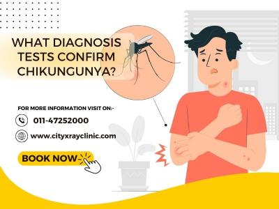 Discover Relief from Chikungunya Symptoms!