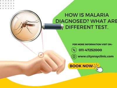 What Is Malaria Fever? Measure Steps To Prevent Malaria  - Delhi Health, Personal Trainer