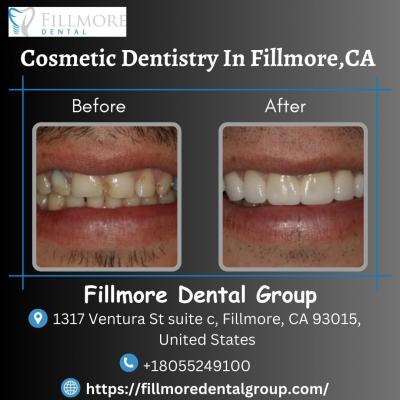 Cosmetic Dentistry in Fillmore,CA - Other Health, Personal Trainer