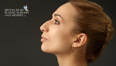 Proper Nose Surgery to Reshape Your Nose - Other Health, Personal Trainer