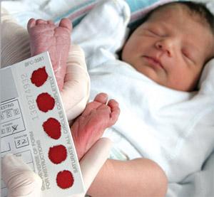 Newborn Screening For Acylcarnitine Test by Agilus Diagnostics - Kolkata Other