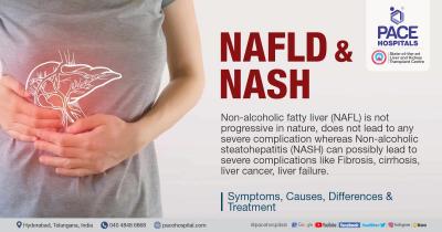 Fatty liver Symptoms, Causes, Differences and Treatment - Hyderabad Health, Personal Trainer