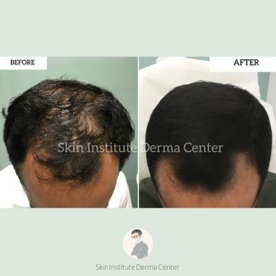 skin clinic abu dhabi | dermatologist | laser hair removal abu dhabi - Abu Dhabi Other