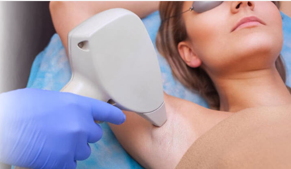 Get Rid of Unwanted Hair with Laser Hair Removal in Bangalore