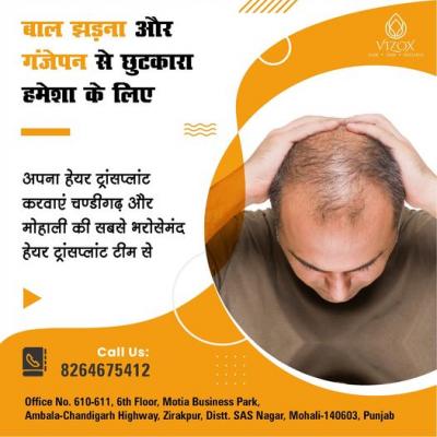 Top Hair Transplant Clinic in Chandigarh
