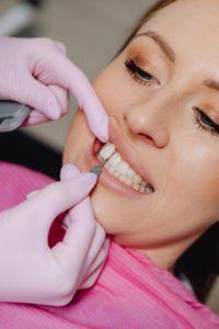 Cosmetic Dentist in Woodland Hills | Dentist of Woodland Hills  - Other Health, Personal Trainer