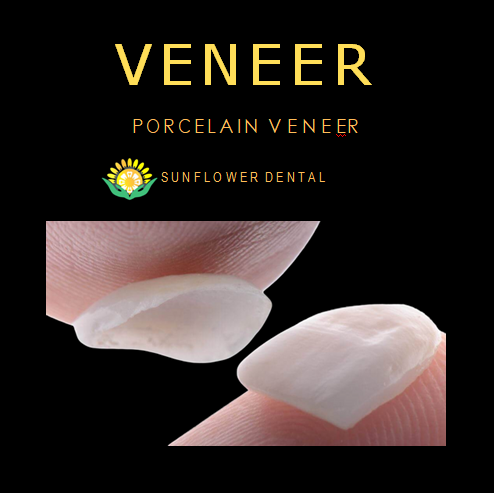 Looking for Non-Prep Veneers Supplier in China - Shenzhen Other