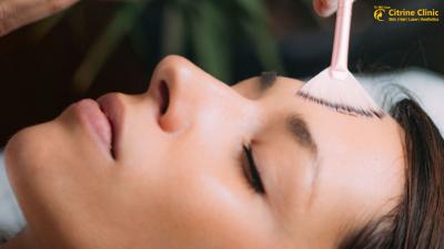 Chemical Peel Treatment in Gurgaon at Citrine Clinic - Gurgaon Health, Personal Trainer
