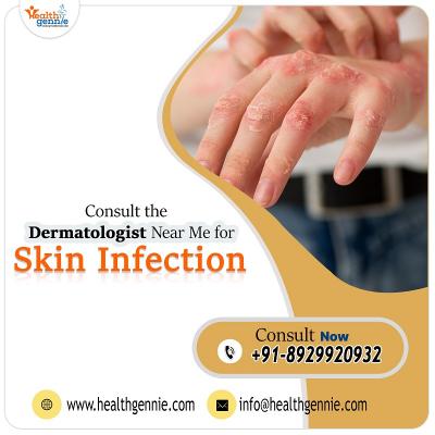 Consult the Dermatologist Near Me for Skin Infection - Jaipur Health, Personal Trainer