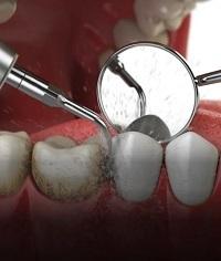 Urgent Dental Care in North London - Emergency Dentist Available Now!