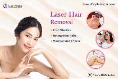 Laser hair removal in Bangalore at Docplus India
