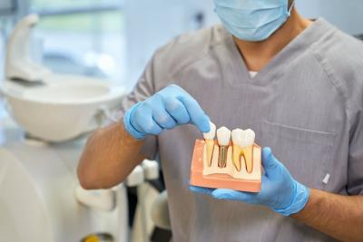 Dental Implant Costs in Monroe, LA - Indianapolis Other