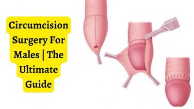 Get Best Affordable Circumcision Surgery Cost in Delhi at Delhi Urology Hospital