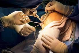 Arthroscopy Surgery Jaipur - Jaipur Health, Personal Trainer