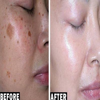 Skin Rejuvenation in Surrey - Other Health, Personal Trainer