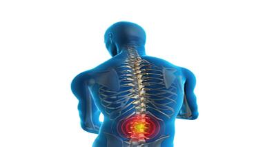 Spondylosis Treatment in Sector 42 Gurgaon - Gurgaon Health, Personal Trainer
