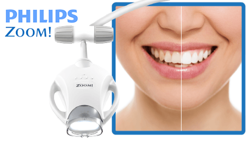 Philips Zoom Whitening – BEDC - Melbourne Professional Services