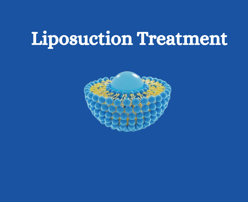 Liposuction Treatment Hospital - Gurgaon Health, Personal Trainer
