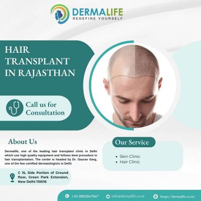 HAIR TRANSPLANT IN RAJASTHAN - Delhi Health, Personal Trainer