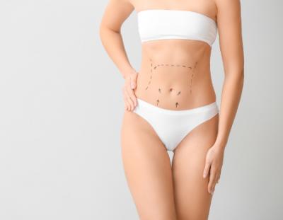 Tummy Tuck Surgery Cost in Bangalore | Tummy tuck Surgery - Bangalore Health, Personal Trainer