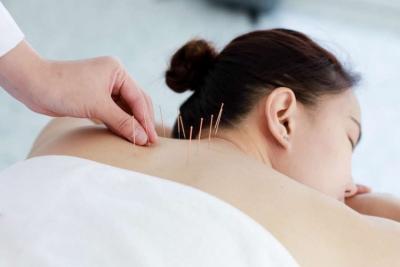 Acupuncture Adelaide - Adelaide Health, Personal Trainer