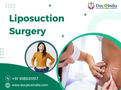 Liposuction Surgery In Hyderabad At Docplus India